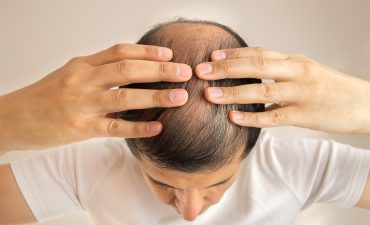 Anwendungsstudie bei Jugendlichen mit einem Shampoo!